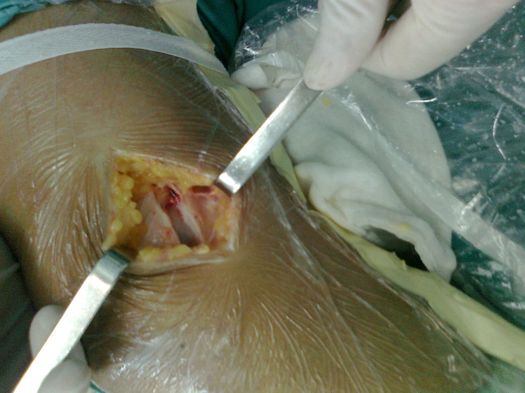 开云电竞:多特15天5战终露疲态 欧冠or联赛?克洛普遇难题(图2) 开云电竞app下载安装